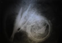 Urnę wojownika sprzed blisko 2 tys. lat prześwietlono u… weterynarza! (GALERIA)