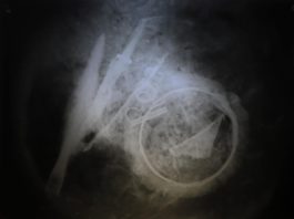 Urnę wojownika sprzed blisko 2 tys. lat prześwietlono u… weterynarza! (GALERIA)