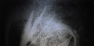 Urnę wojownika sprzed blisko 2 tys. lat prześwietlono u… weterynarza! (GALERIA)