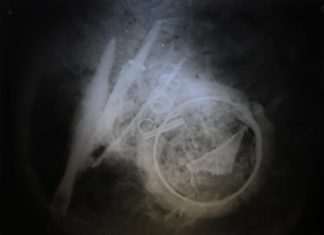 Urnę wojownika sprzed blisko 2 tys. lat prześwietlono u… weterynarza! (GALERIA)