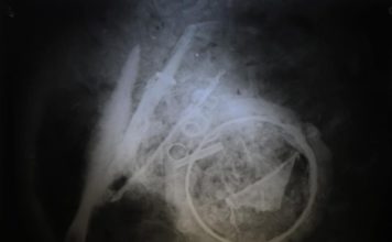 Urnę wojownika sprzed blisko 2 tys. lat prześwietlono u… weterynarza! (GALERIA)