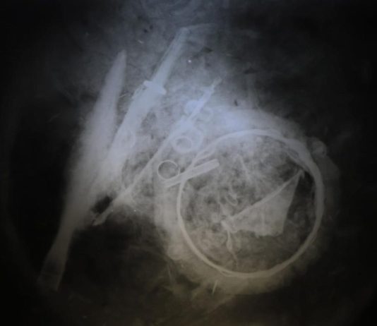 Urnę wojownika sprzed blisko 2 tys. lat prześwietlono u… weterynarza! (GALERIA)