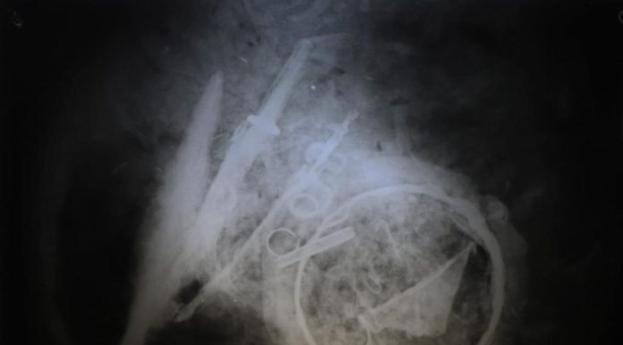 Urnę wojownika sprzed blisko 2 tys. lat prześwietlono u… weterynarza! (GALERIA)