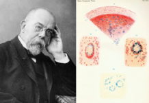 Wąglik, gruźlica i genialne dziecko… Robert Koch – laureat Nobla z 1905