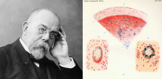Wąglik, gruźlica i genialne dziecko… Robert Koch – laureat Nobla z 1905