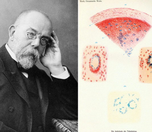 Wąglik, gruźlica i genialne dziecko… Robert Koch – laureat Nobla z 1905