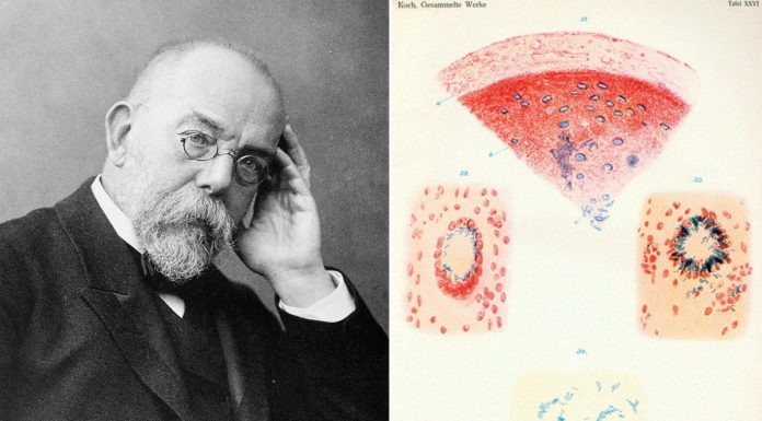 Wąglik, gruźlica i genialne dziecko… Robert Koch – laureat Nobla z 1905