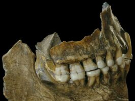 Próchnica była już 9 tys. lat temu na terenie Polski